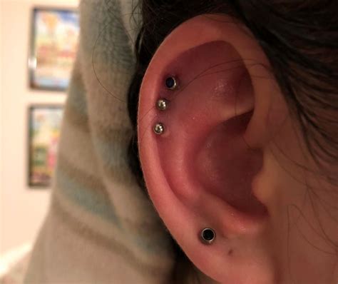 cartilage piercing blister|piercing bumps on cartilage.